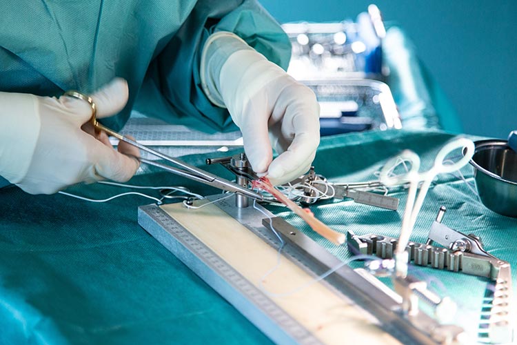reconstruction du ligament croisé antérieur chirurgie conservatrice du genou centre chirugical orthopédie Rochefort  Charente Maritime